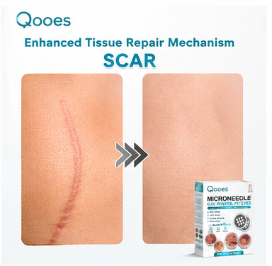 Qooes®2-in-1 Microneedle & Hydrocolloid Patch👨‍⚕️ | Removes raised moles, acne, flat warts, and skin tags | Helps improve wrinkles, scars, and blemishes | Invisible patches for face and body💖