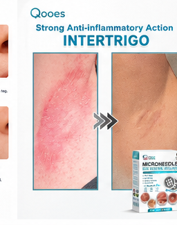 Qooes®2-in-1 Microneedle & Hydrocolloid Patch👨‍⚕️ | Removes raised moles, acne, flat warts, and skin tags | Helps improve wrinkles, scars, and blemishes | Invisible patches for face and body💖