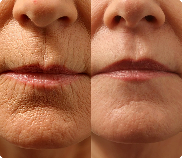 Qooes 4D Hyaluronic Deep Hydration & Age-Defying Serum