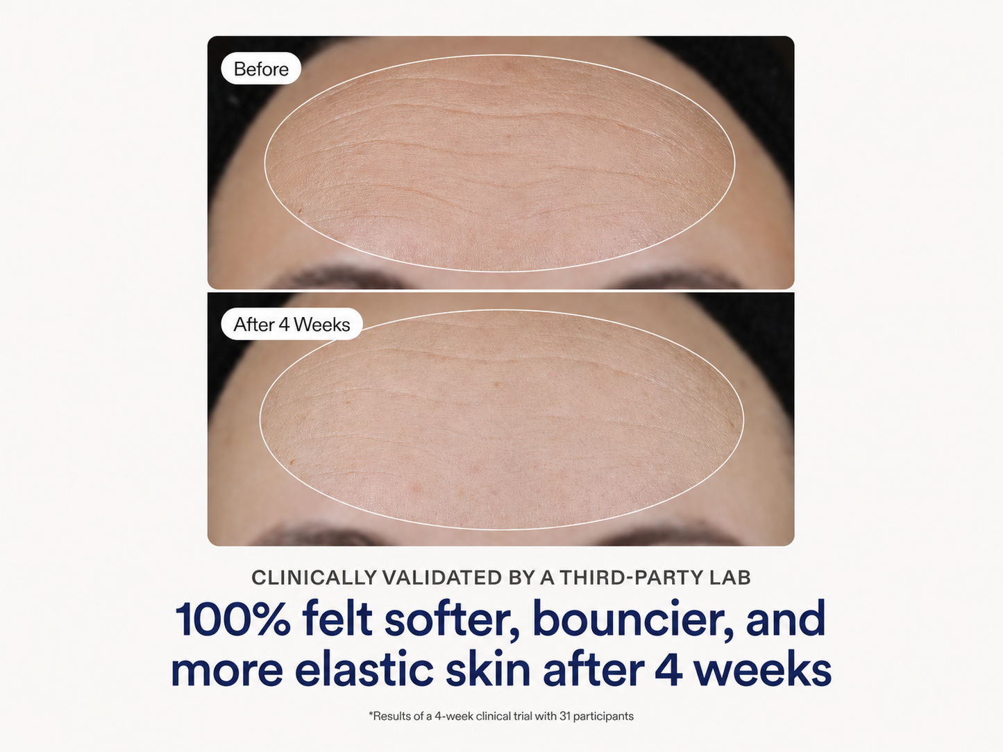 Slimoly® Barrier Cloud Ceramide Cream