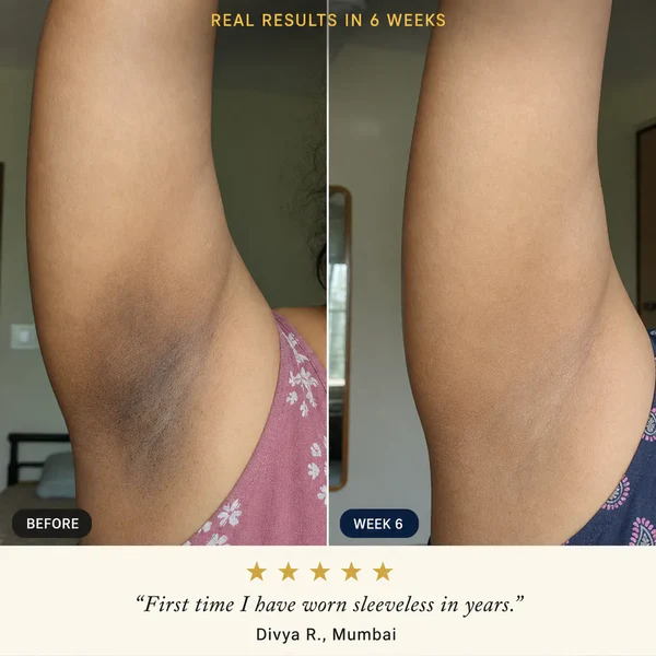 MISSPONE Underarm Glow Reset Cream