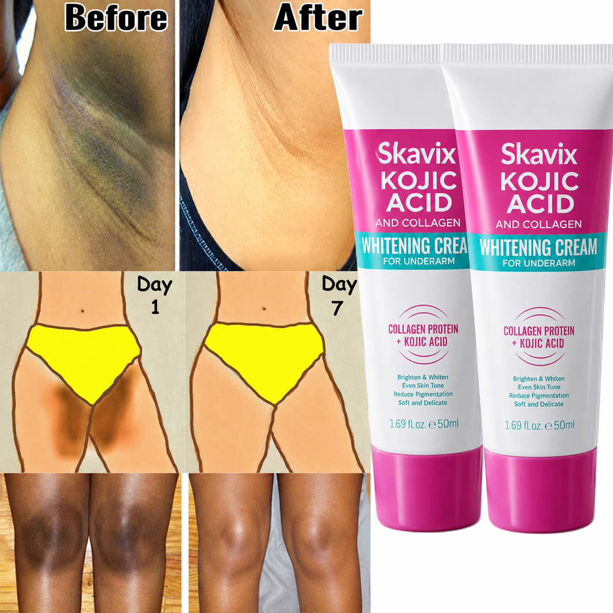 Skavix® Underarm Glow Reset Cream – Visibly Brighter, Smoother & More Even-Looking Skin