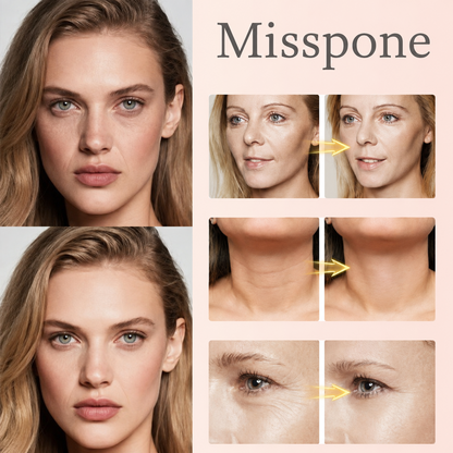 ✨ Misspone®  Advanced Peptide Collagen Firming Concentrate – Wrinkle-Smoothing & Elasticity Care