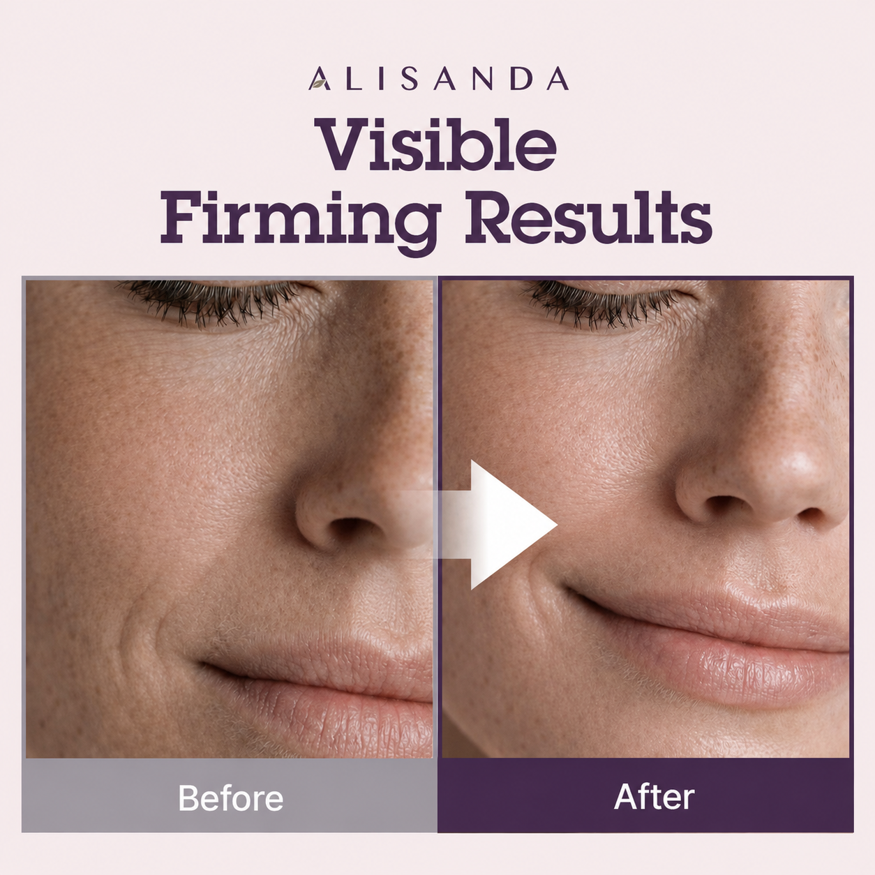 Alisanda NeckRenew visible firming results
