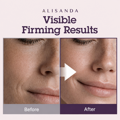 Alisanda® NeckRenew Anti-Aging Firming Cream