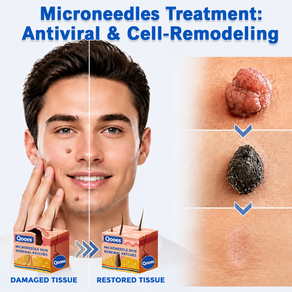 Qooes®2-in-1 Microneedle & Hydrocolloid Patch👨‍⚕️ | Removes raised moles, acne, flat warts, and skin tags | Helps improve wrinkles, scars, and blemishes | Invisible patches for face and body💖