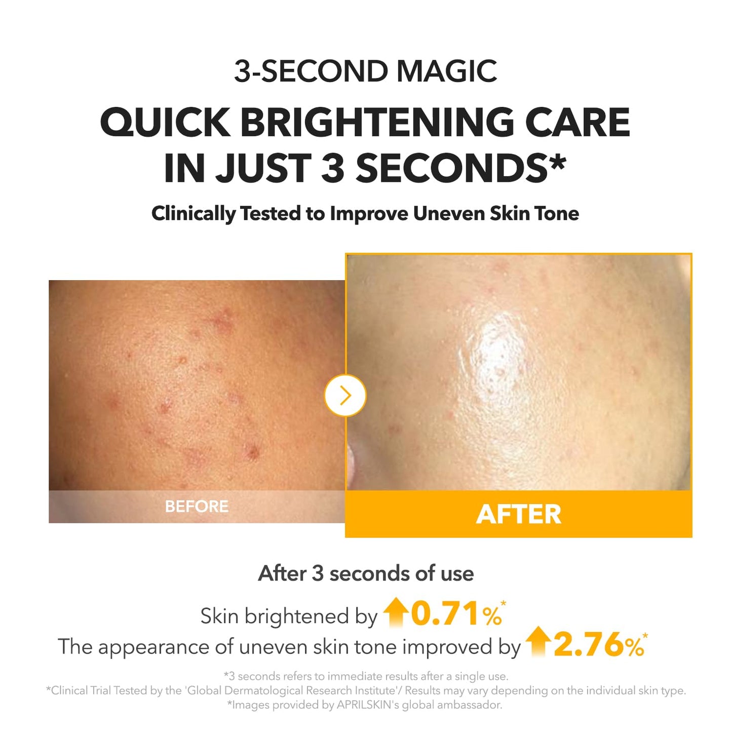 Qooes™ Vita Kojic Radiance Serum